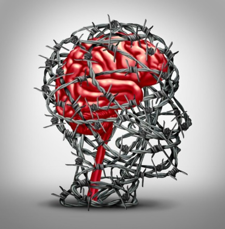 cerveau emprisonné de barbelés